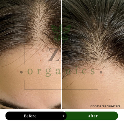 Hair Repair Oil Bundle
